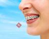 Agenter Orthodontics