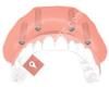 Dental Implant Solutions Greer, SC