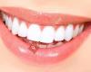 Luxor Dental | Prosthodontist, Dental Implants & wisdom teeth Surgery Center