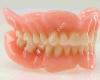 TW denture and Repair