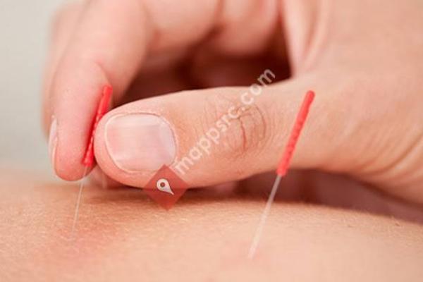 Acupuncture, Pain Management & Skin Care Clinic