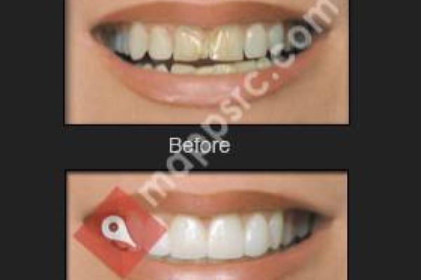 Perfect Smiles Dental Care